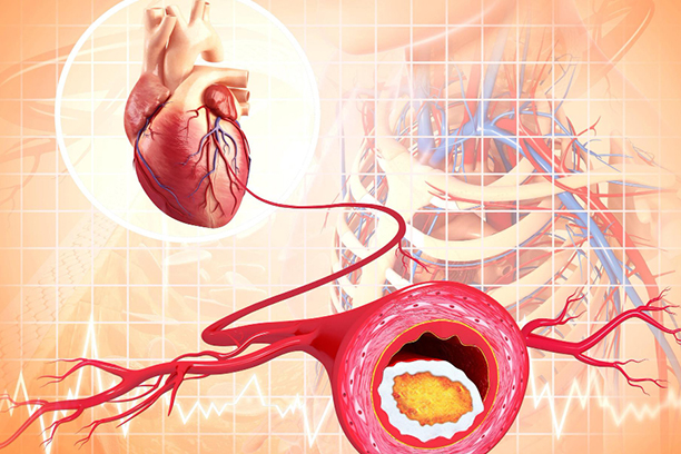 Complete Guide to Coronary Angiography